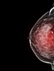 ad0923e399c428b1c7997d91c0e54d34_1761714727_7534.jpg ad0923e399c428b1c7997d91c0e54d34_1761714